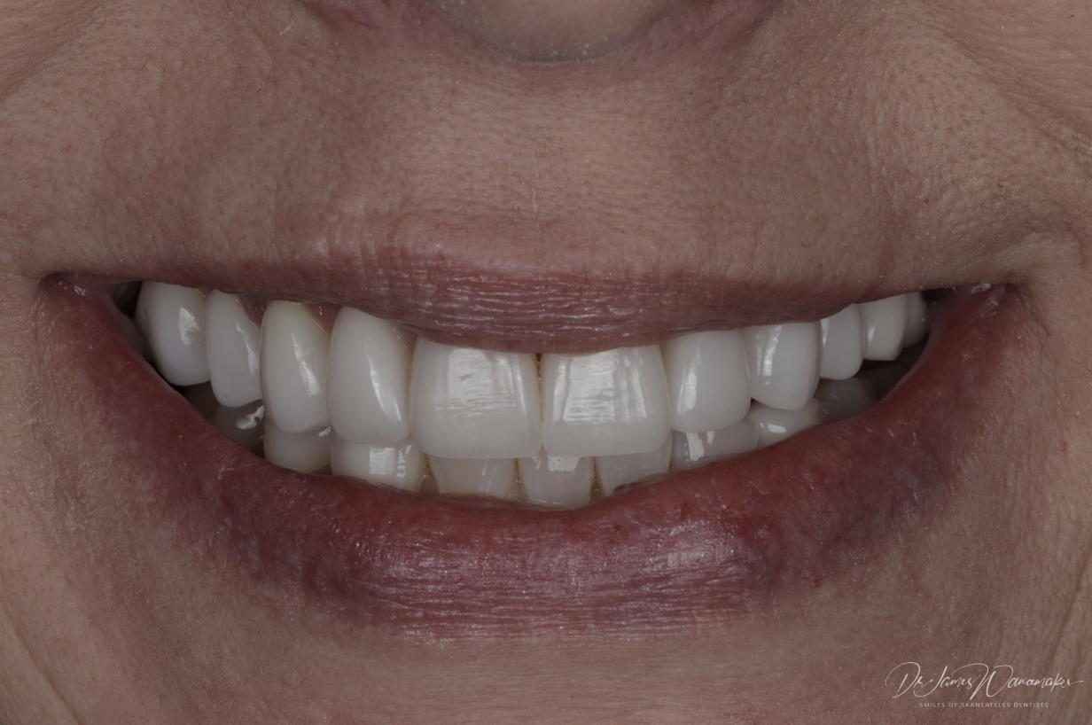 cosmetic dentistry photo 2