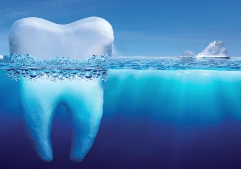 best fluoride toothpaste for gum health
